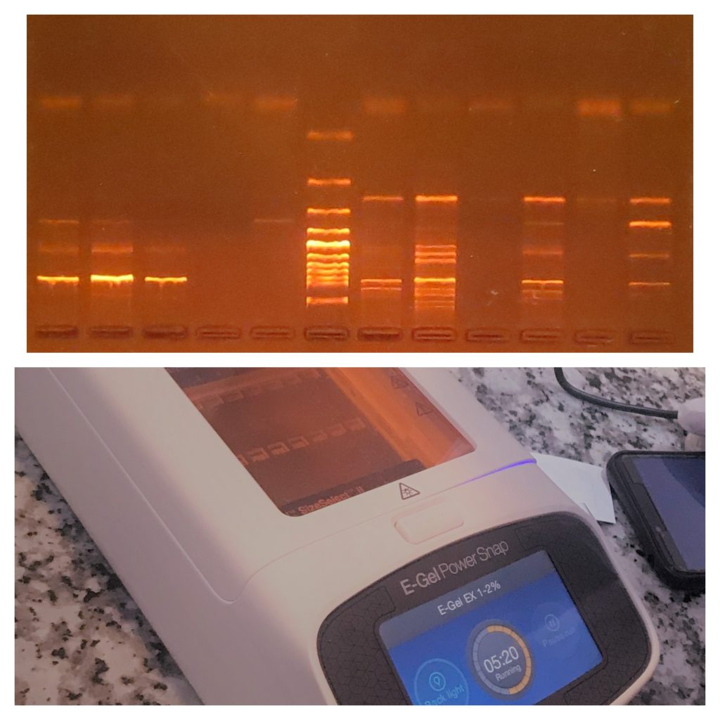  Agarose gel elctrophoresis and E-Gel electrophoresis