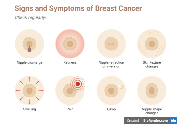 Fig: sign and symptoms of breast cancer