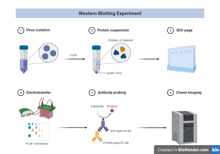 Western Blotting- Principle, Steps, Extraction, Applications - Sciencevivid