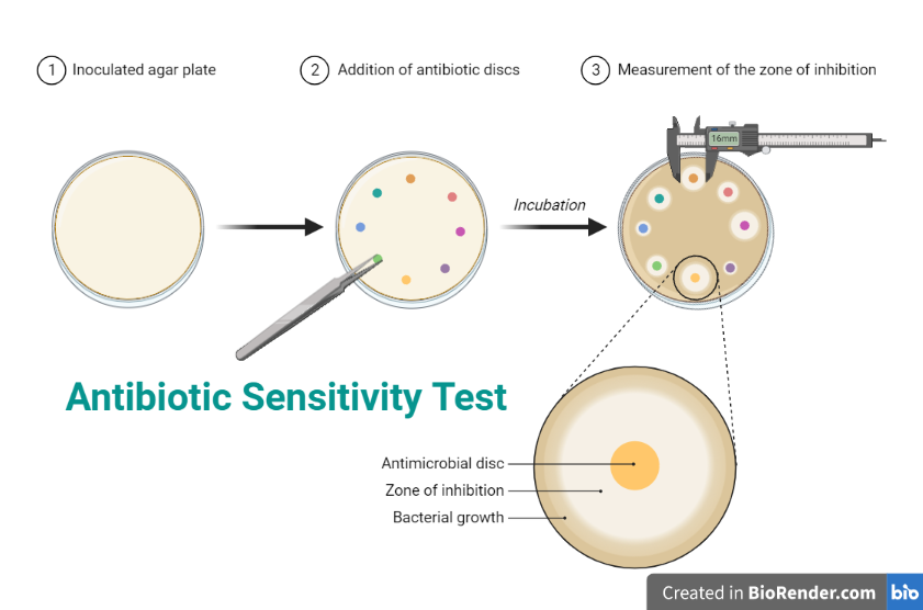 Antimicrobial Susceptibility Testing AST Types And Applications 