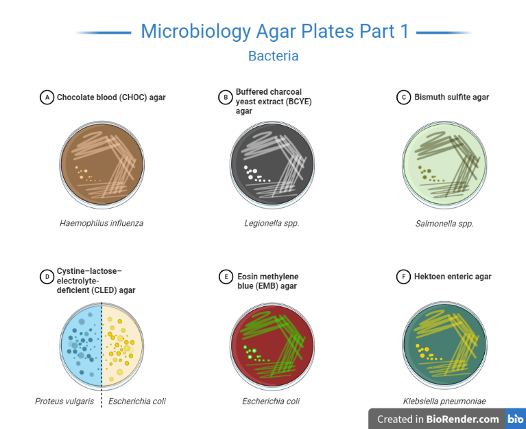 How To Make Agar Plates For Bacteria At Joseph Russo Blog
