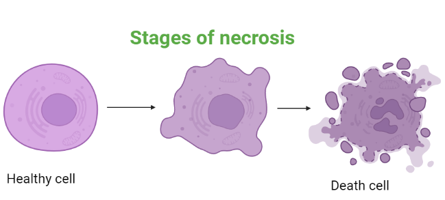 Stages of necrosis