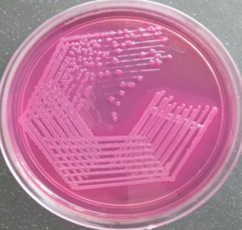 Antimicrobial Susceptibility Testing