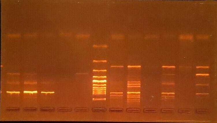 The DNA band under the UV transilluminator  