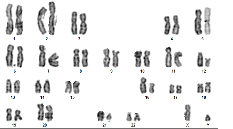 Karyotiping 