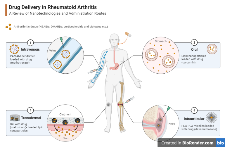 Drug delivery in Rheumatoid arthritis (RA)