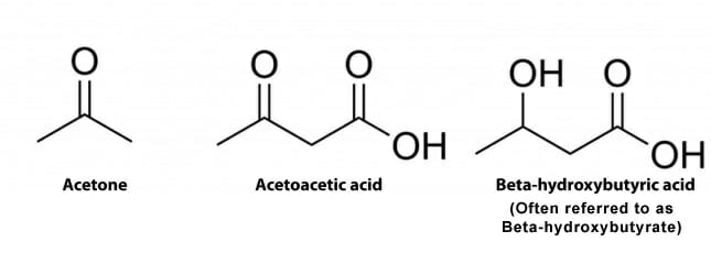 Types of ketone bodies 