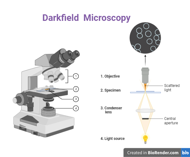 Dark field microscope