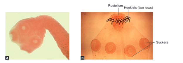 Carmine-stained scolex of Taenia saginata (A) and Taenia solium (B).
(A) shows the scolex of T. saginata lacking hooklets, while (B) displays the scolex of T. solium with a rostellum and two rows of hooklets. Both images highlight the suckers used for attachment to the host's intestinal wall.