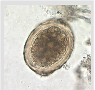 A. lumbricoides decorticated, fertile egg in a wet mount, 400X magnification