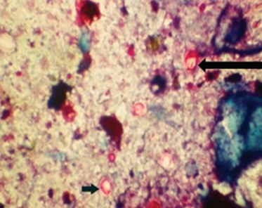 Cryptosporidium parvum oocysts ranging from 4 to 6 μm in size.