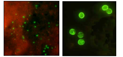 Cryptosporidium parvum oocysts under DFA
