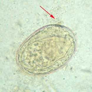  Egg of S. japonicum in an unstained wet mount