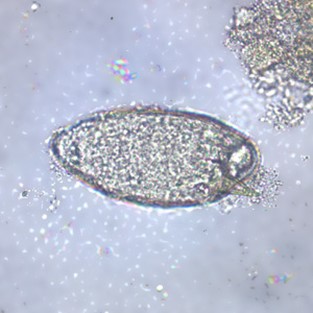Egg of S. mansoni in an unstained wet mount