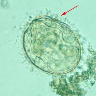  Egg of S. mekongi