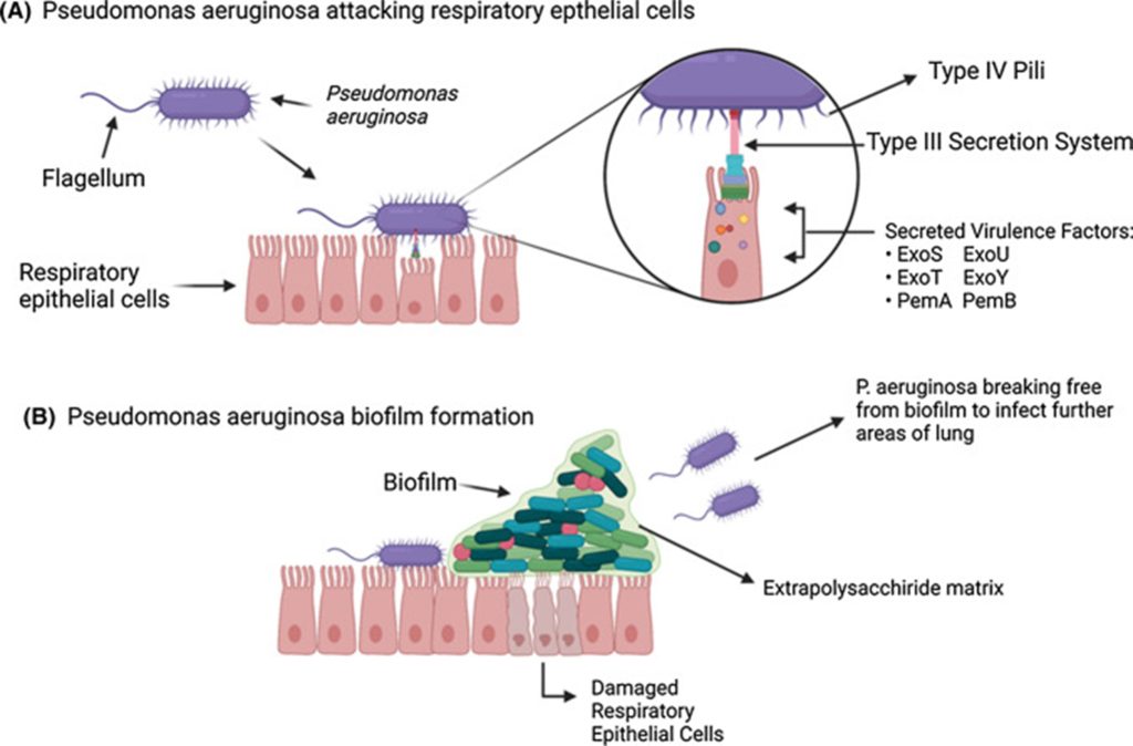 Pathogenesis of Pseudomonas aeruginosa causing human infection
