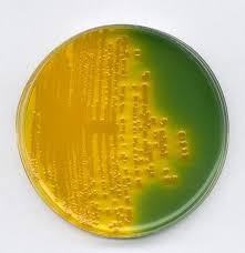 Vibrio cholerae on TCBS