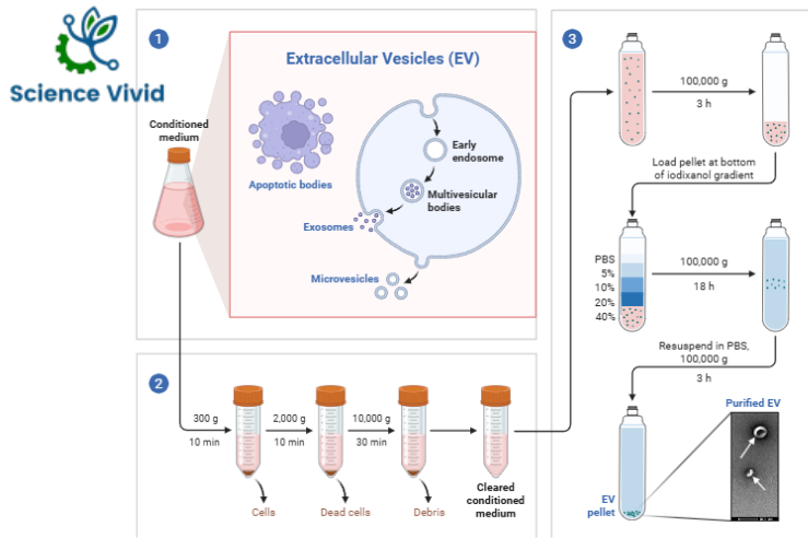 Isolation of Extracellular vesicles (EVs)